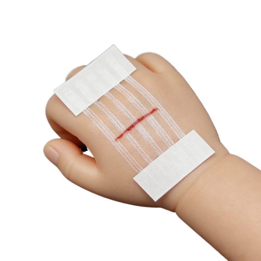 Medical Label - 5 แถบปิดแผล แถบปิดแผลหลังคลอด แถบซ่อมแซมแผลหลังคลอด แถบศัลยกรรมความงาม เทปกาวทางการแพทย์