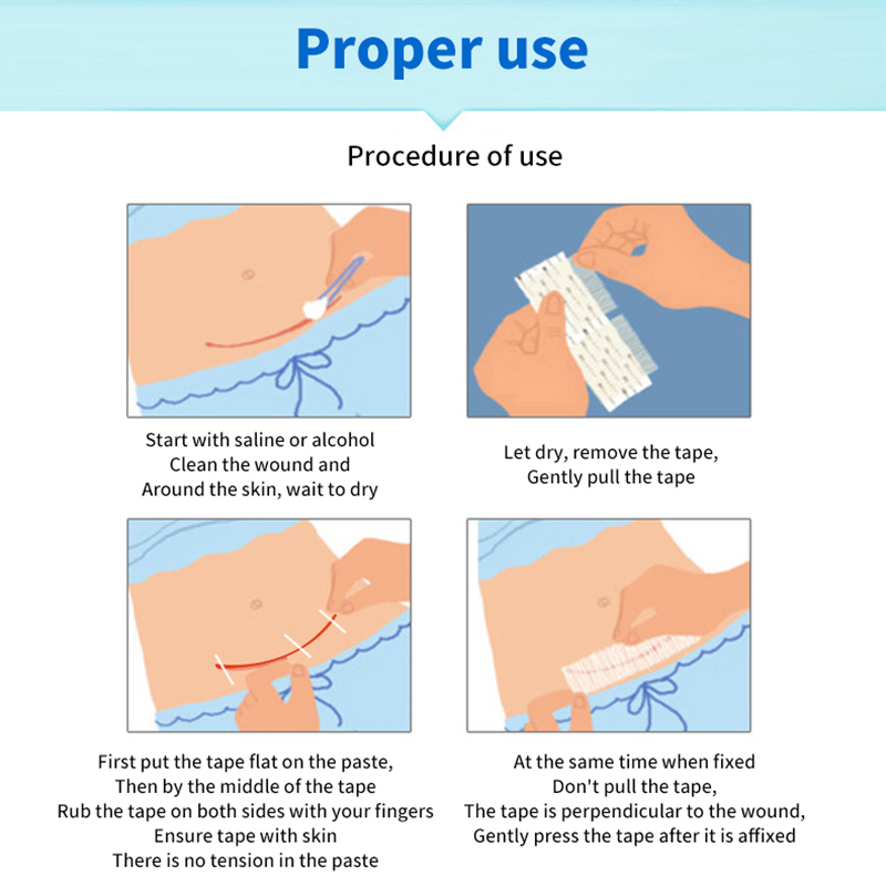 5 แถบปิดแผล แถบปิดแผลหลังคลอด  - Medical Label บทวิจารณ์และราคา