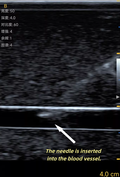 แบบจำลองฝึกเจาะหลอดเลือดด้วยอั - Medical Gel Ultrasound บทวิจารณ์และราคา